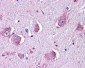 HRH1 / Histamine H1 Receptor Antibody (Extracellular Domain)